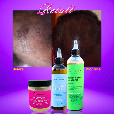 Hair Detox and Grow Bundle Thicken, Moisturize, Revitalize, GROW!