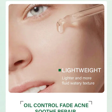 Does tea tree serum work for acne-prone skin