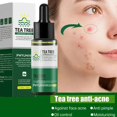 Tea tree acne serum