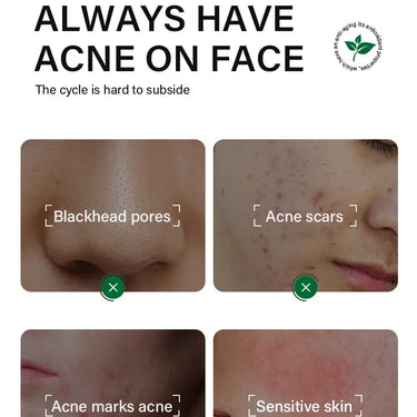 Can tea tree oil serum help reduce acne scars